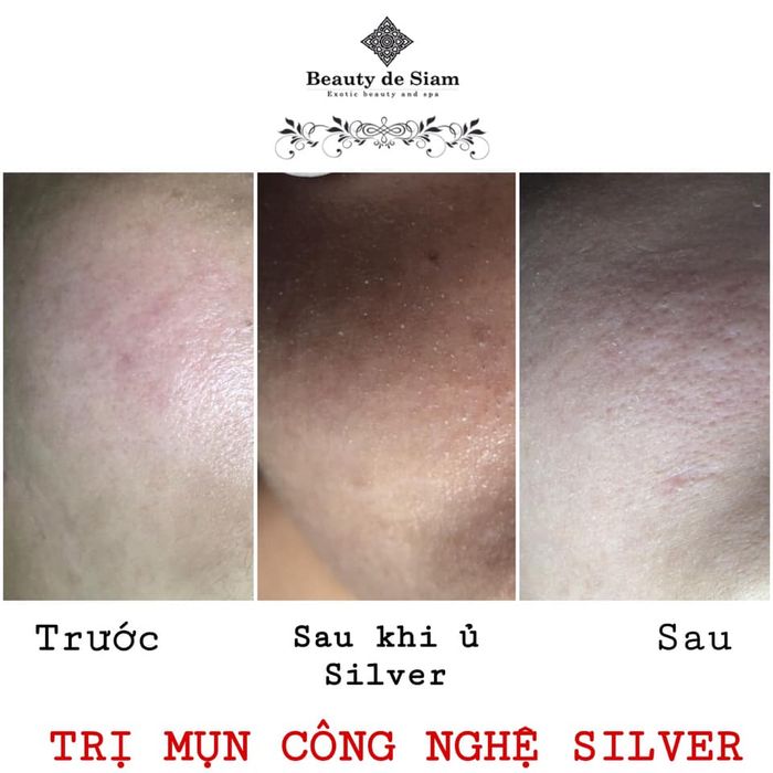 Hình ảnh Beauty de Siam Tiền Giang 1