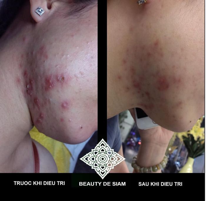Hình ảnh Beauty de Siam Tiền Giang 2