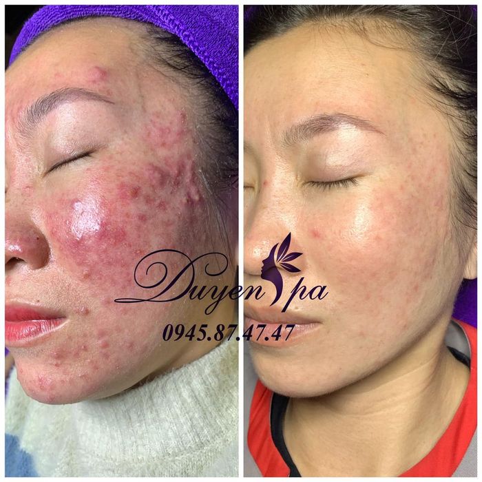 Hình ảnh Duyên Spa Mỹ Tho 1