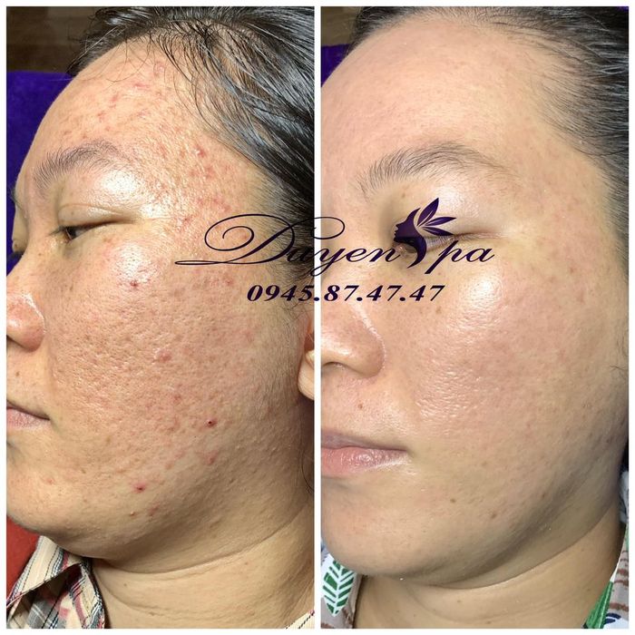 Hình ảnh Duyên Spa Mỹ Tho 2