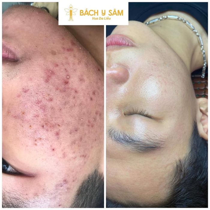 Hình ảnh Milkky Beauty Spa 2