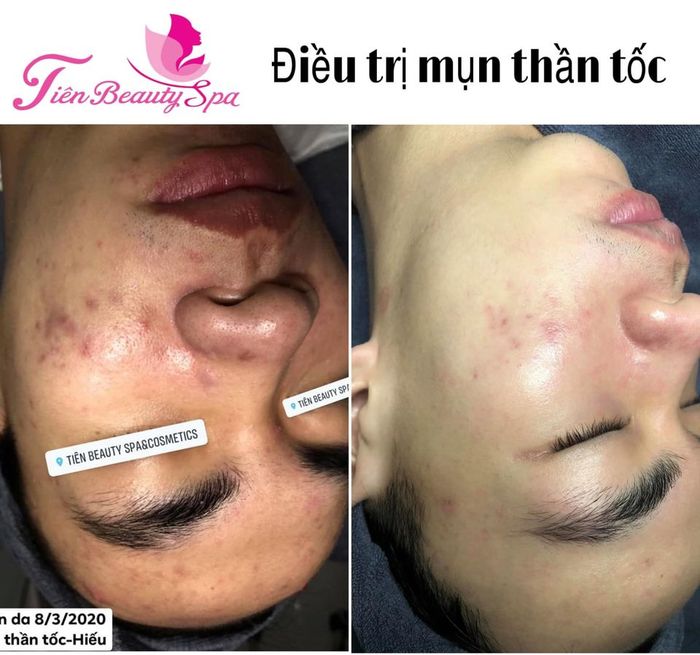 TIÊN BEAUTY SPA hình ảnh 1