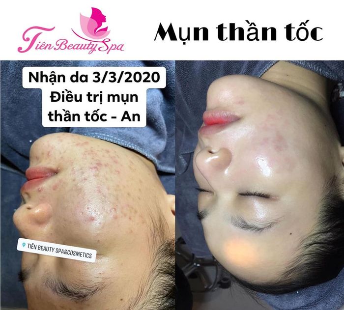 TIÊN BEAUTY SPA hình ảnh 2