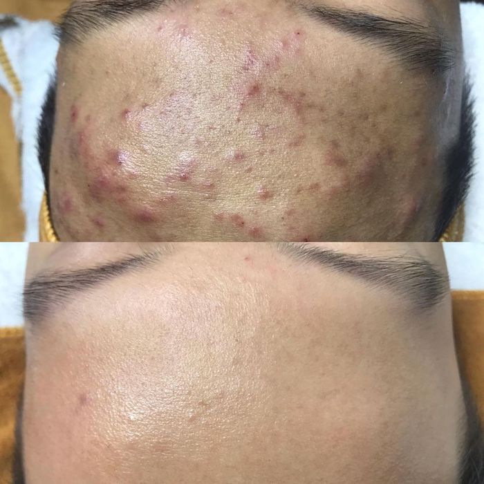 Hình ảnh Yura Spa 1