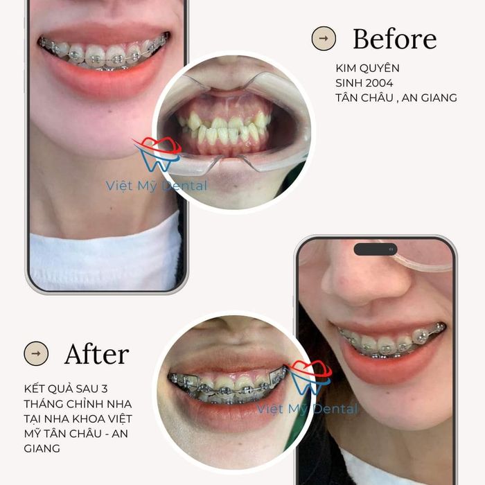 Ảnh 2 của Nha Khoa Việt Mỹ