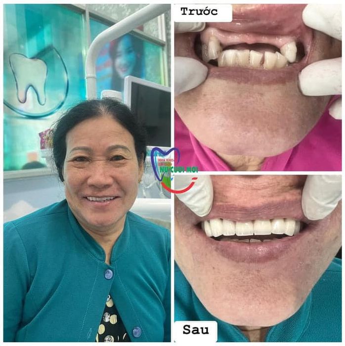 Nha khoa Sài Gòn Nụ Cười Mới ảnh 1