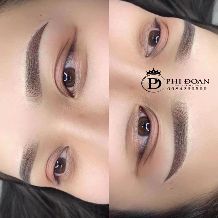 Hình ảnh của Thẩm Mỹ Phi Đoan 1