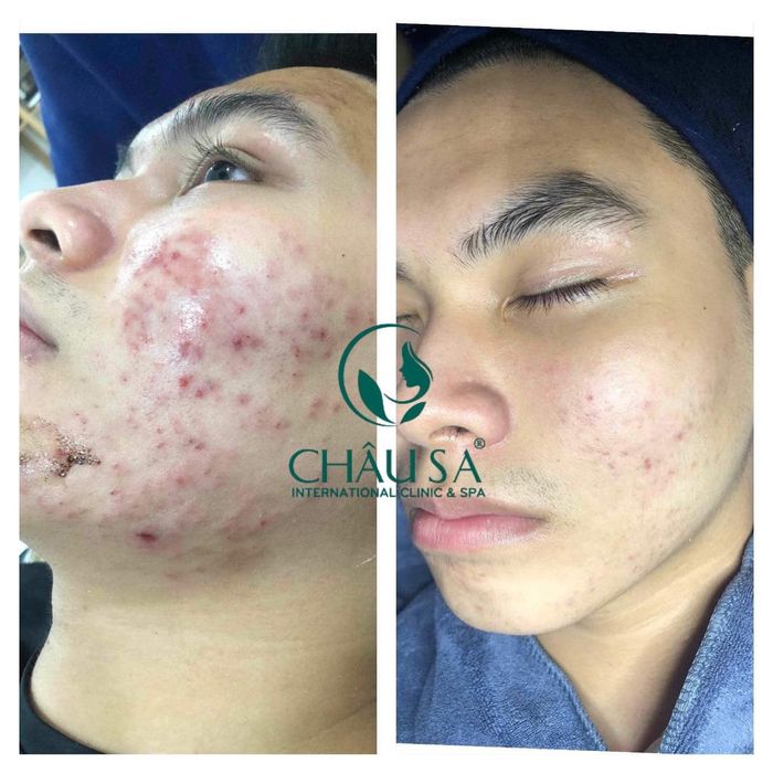 CHÂU SA SPA GIA LAI - Viện Thẩm Mỹ Công Nghệ Cao - Hình ảnh 2