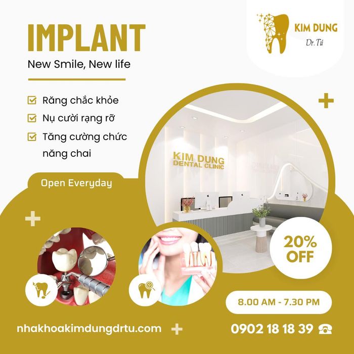 Quy trình cấy ghép implant chuyên nghiệp tại Nha Khoa Kim Dung Dr Tú