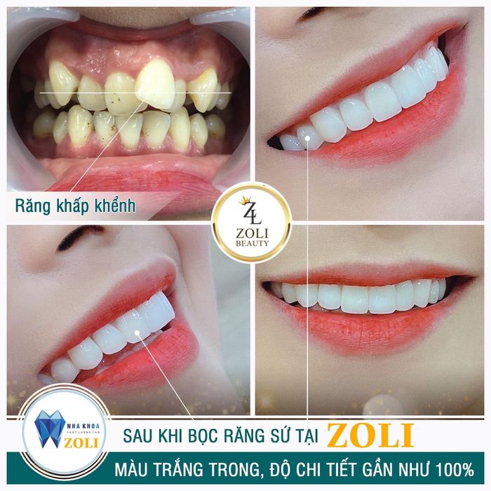 Hình ảnh Nha Khoa Thẩm Mỹ Zoli