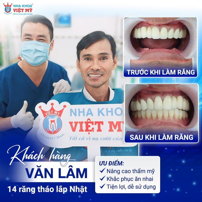 Hệ thống trang thiết bị hiện đại tại Nha Khoa Việt Mỹ