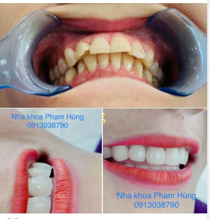 Nha khoa Phạm Hùng ảnh 2