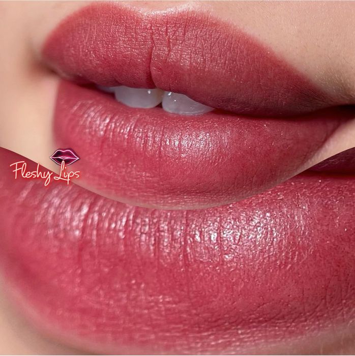 Hình ảnh Thẩm Mỹ Quốc Tế Long Oanh - 2