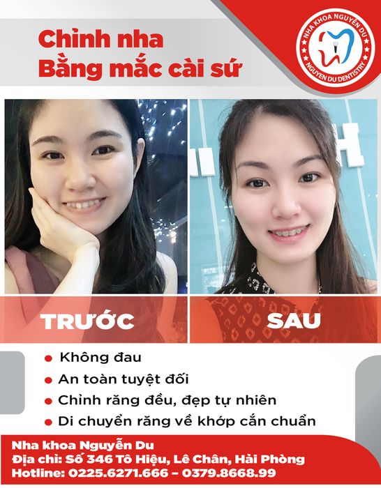Nha Khoa Bảo Châu hình ảnh 3