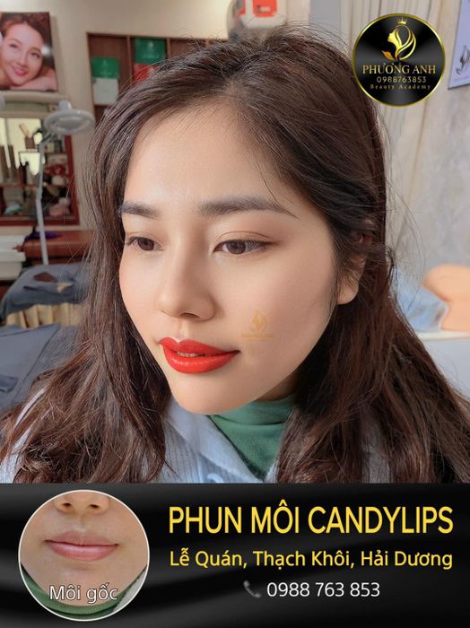 Thẩm Mỹ Phương Anh hình 1