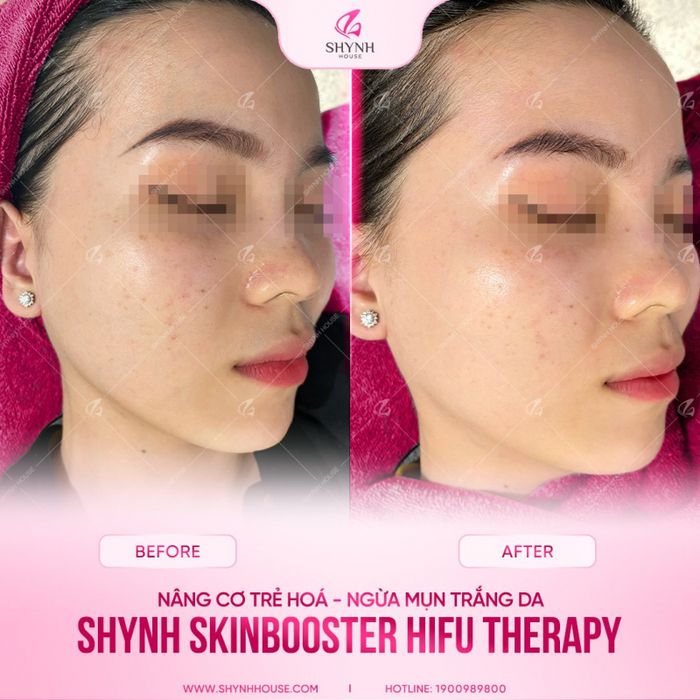 Shynh House - Hình ảnh 2: Quy trình chăm sóc da công nghệ cao