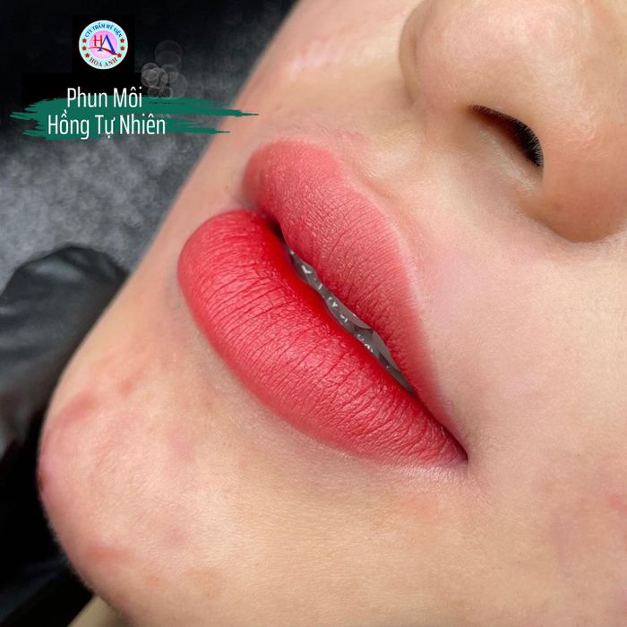 Hoa Anh Beauty Clinic Image 1