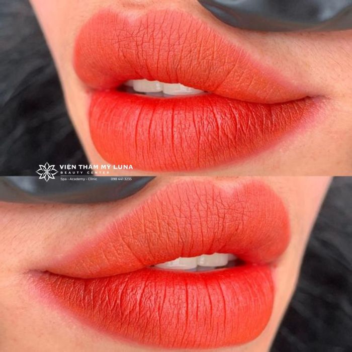 Ảnh của Thẩm Mỹ Viện Luna