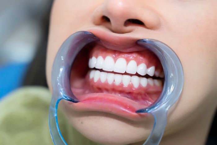 Hình ảnh 3 của Nha Khoa Thẩm Mỹ SMILE ART