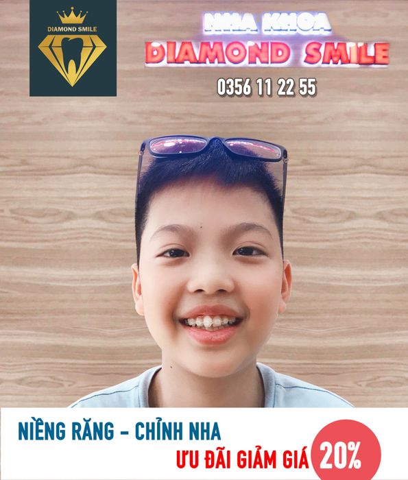 Hình ảnh 2 của Nha khoa Diamond Smile Tuyên Quang