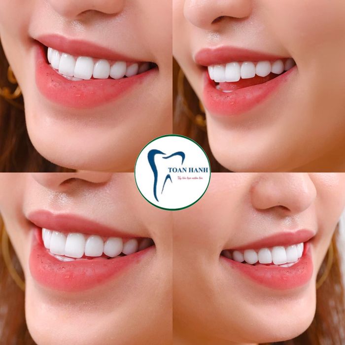 Nha Khoa Toàn Hạnh ảnh 1