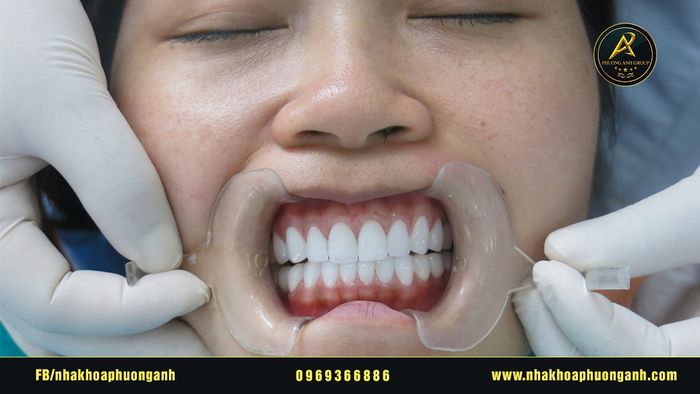 Hình ảnh của NHA KHOA PHƯƠNG ANH