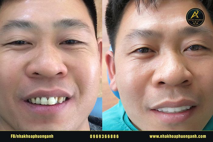 Hình ảnh của NHA KHOA PHƯƠNG ANH - Ảnh 2