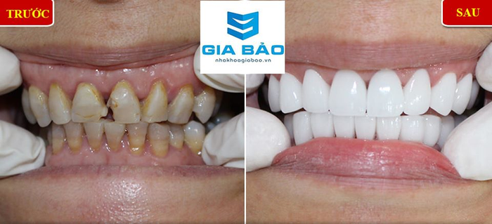 Hình ảnh cơ sở vật chất hiện đại tại Nha Khoa Gia Bảo