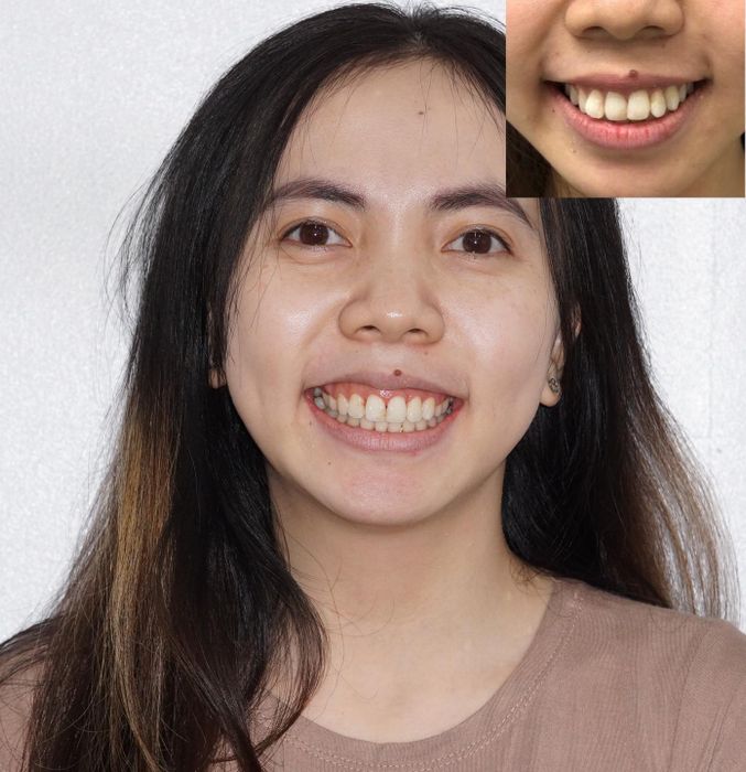 Nha Khoa Lan Anh ảnh 2