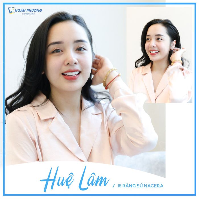 Hình ảnh 1 của Nha Khoa Ngân Phượng