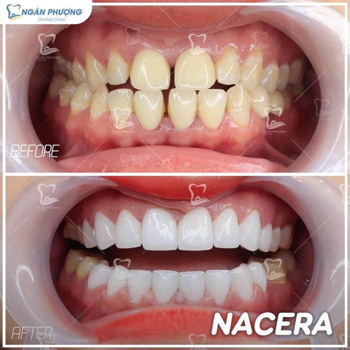 Hình ảnh 2 của Nha Khoa Ngân Phượng