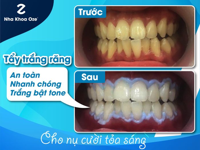 Hình ảnh 1 của Nha Khoa Oze
