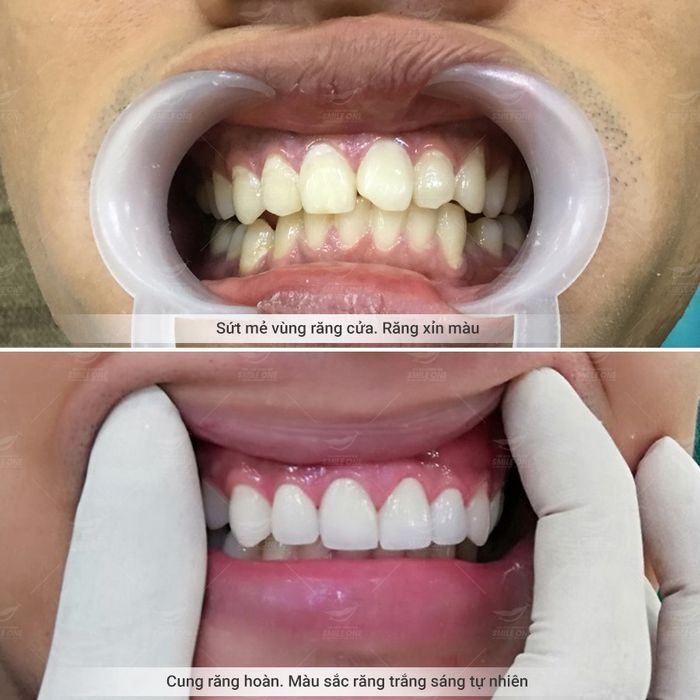 Hình ảnh 1 của Nha Khoa Smile One