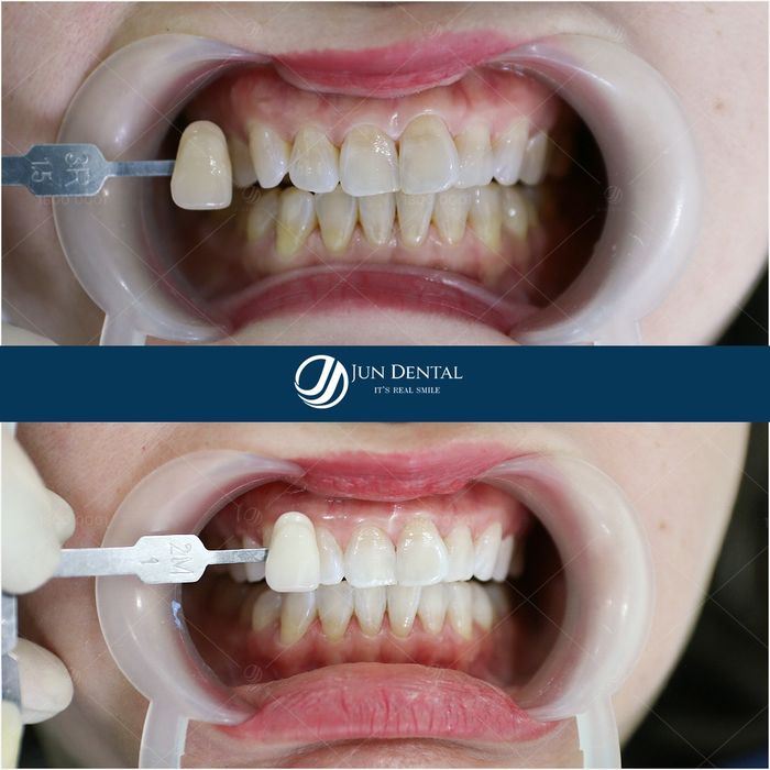 Hình ảnh 2 của Nha Khoa Thẩm Mỹ Quốc Tế Jun Dental