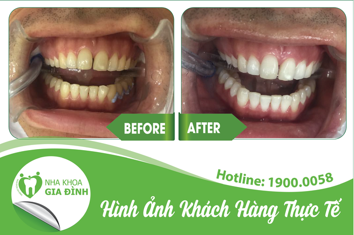 Nha khoa Gia Đình hình ảnh 1