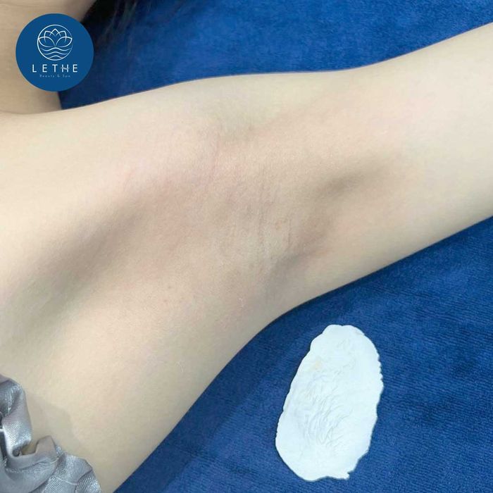 Hình ảnh LeThe Spa & Beauty