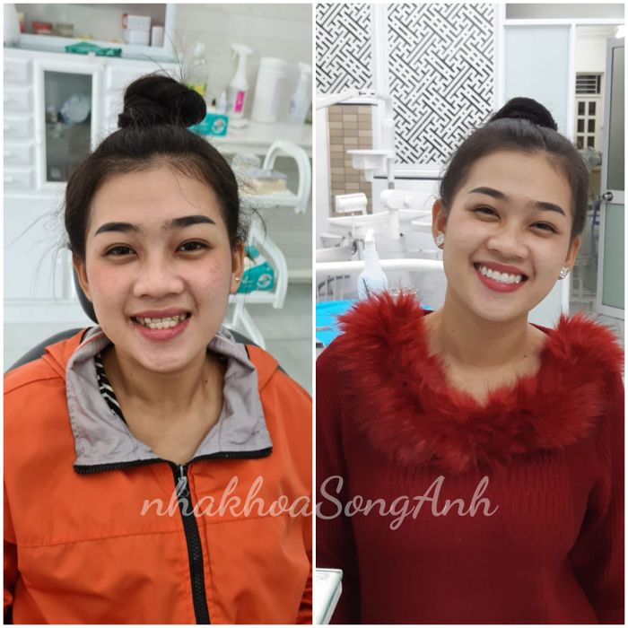 Ảnh của Nha khoa Song Anh 2