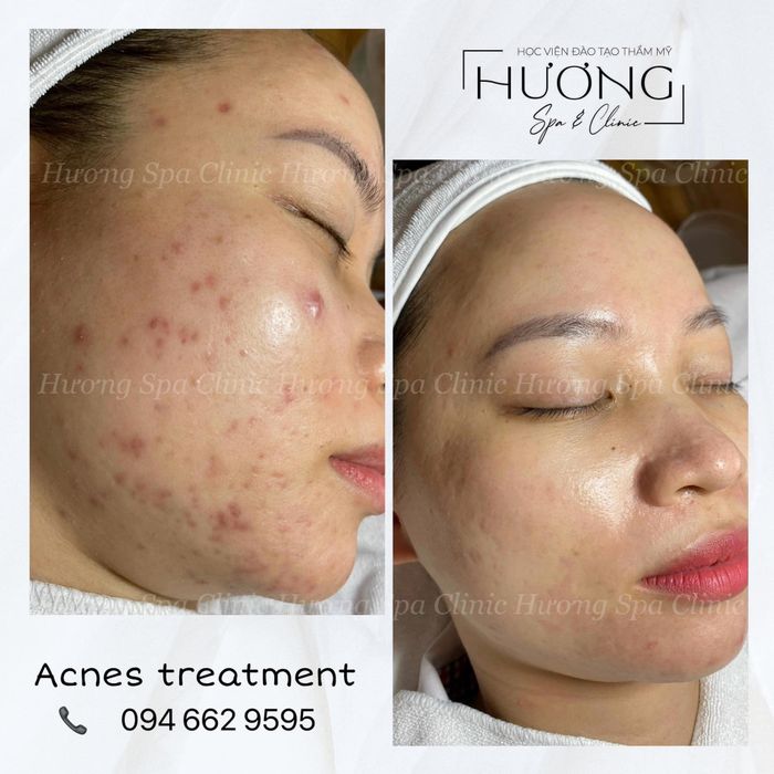 Ảnh 1 - Không gian sang trọng và dịch vụ chuyên nghiệp tại Hương Spa & Clinic