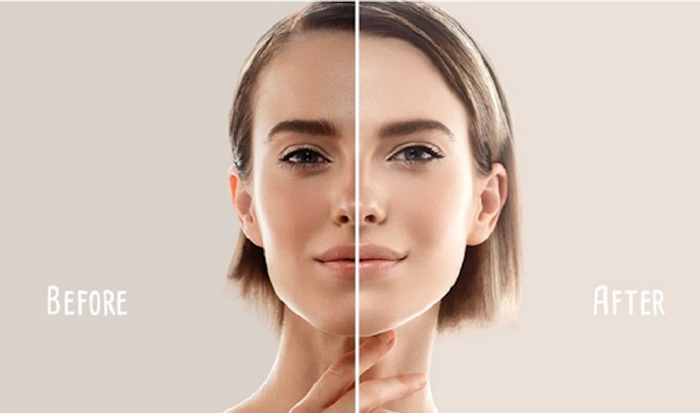 Trước và sau khi sử dụng Serum dưỡng trắng da mờ vết thâm