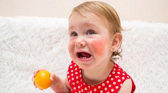 Trẻ bị dị ứng có nên sử dụng dầu hạt mè không?