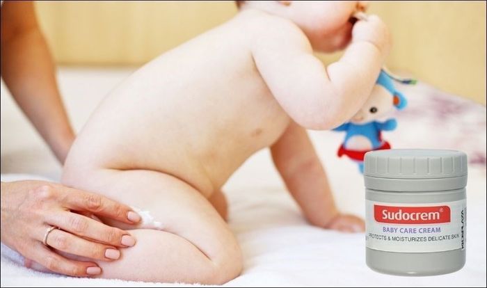 Thoa một lớp kem Sudocrem mỏng nhẹ