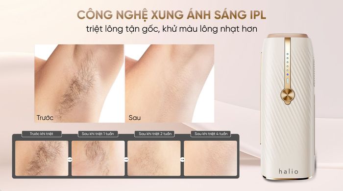 Máy triệt lông lạnh Sapphire Halio Infinity Glow Advanced IPL - Công nghệ IPL