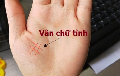 Vân tay hình chữ Tỉnh