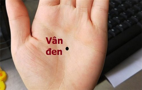 Đường vân đen