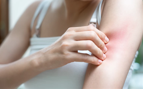Ngứa hoặc tê da đột ngột