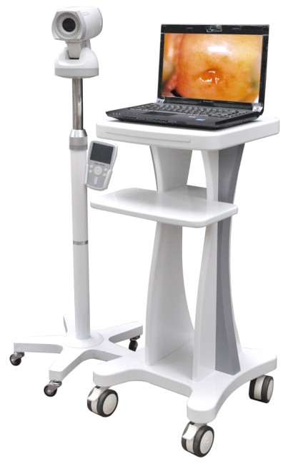 Máy nội soi cổ tử cung BT2000