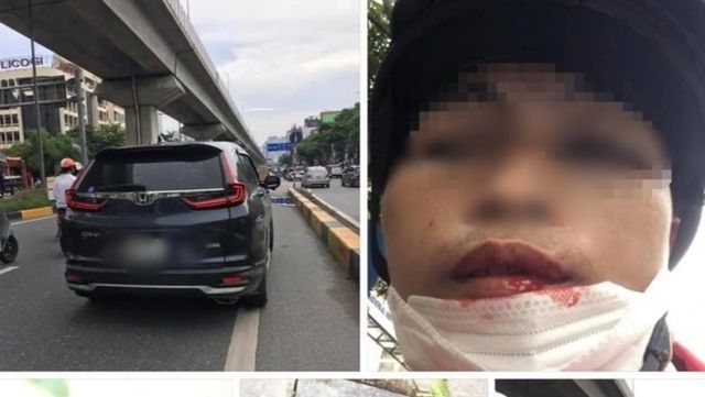 Tài xế xe ôm bị lái xe CR-V đánh gãy răng vì không cho vượt - Ảnh 1.