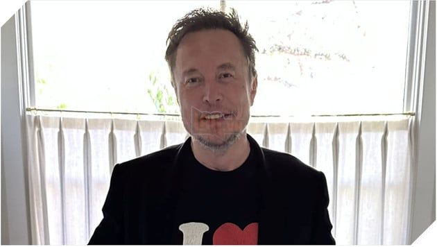 Bí ẩn đen tối phía sau các thí nghiệm cấy ghép não lên khỉ của Elon Musk 2