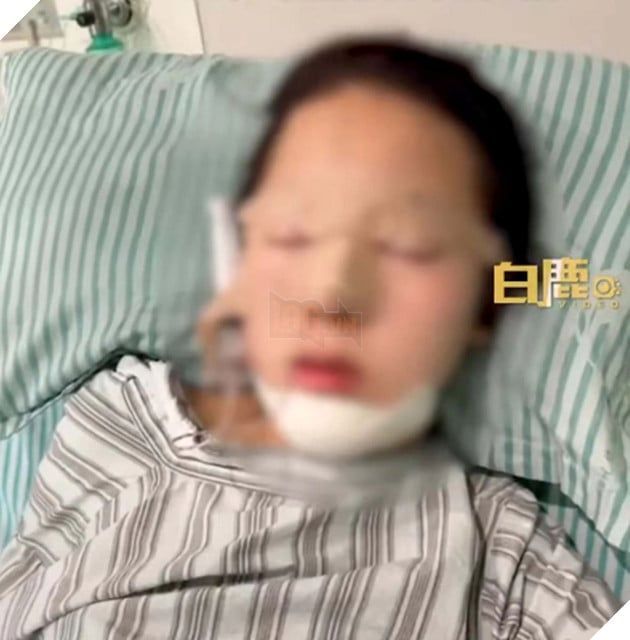 Phẫu thuật thẩm mỹ để chữa nghiện game: Điều bất thường của một gia đình Trung Quốc