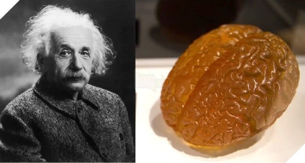 Bộ não của Einstein hiện nay ở đâu? 